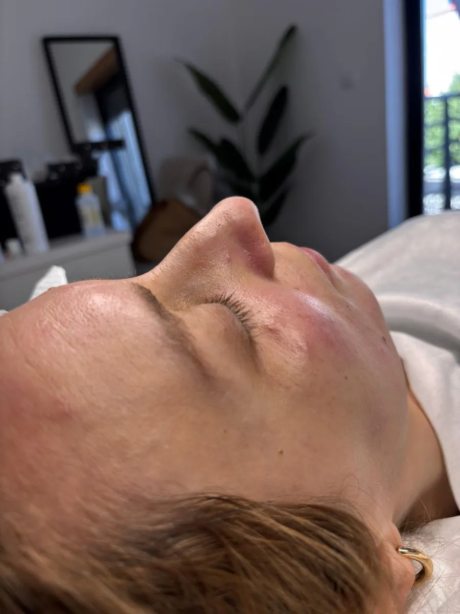 Resultado de cuidado estético na Ryca Beauty