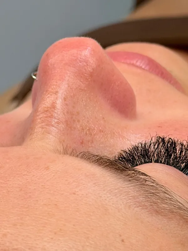 Pele depois de um tratamento facial autorizado