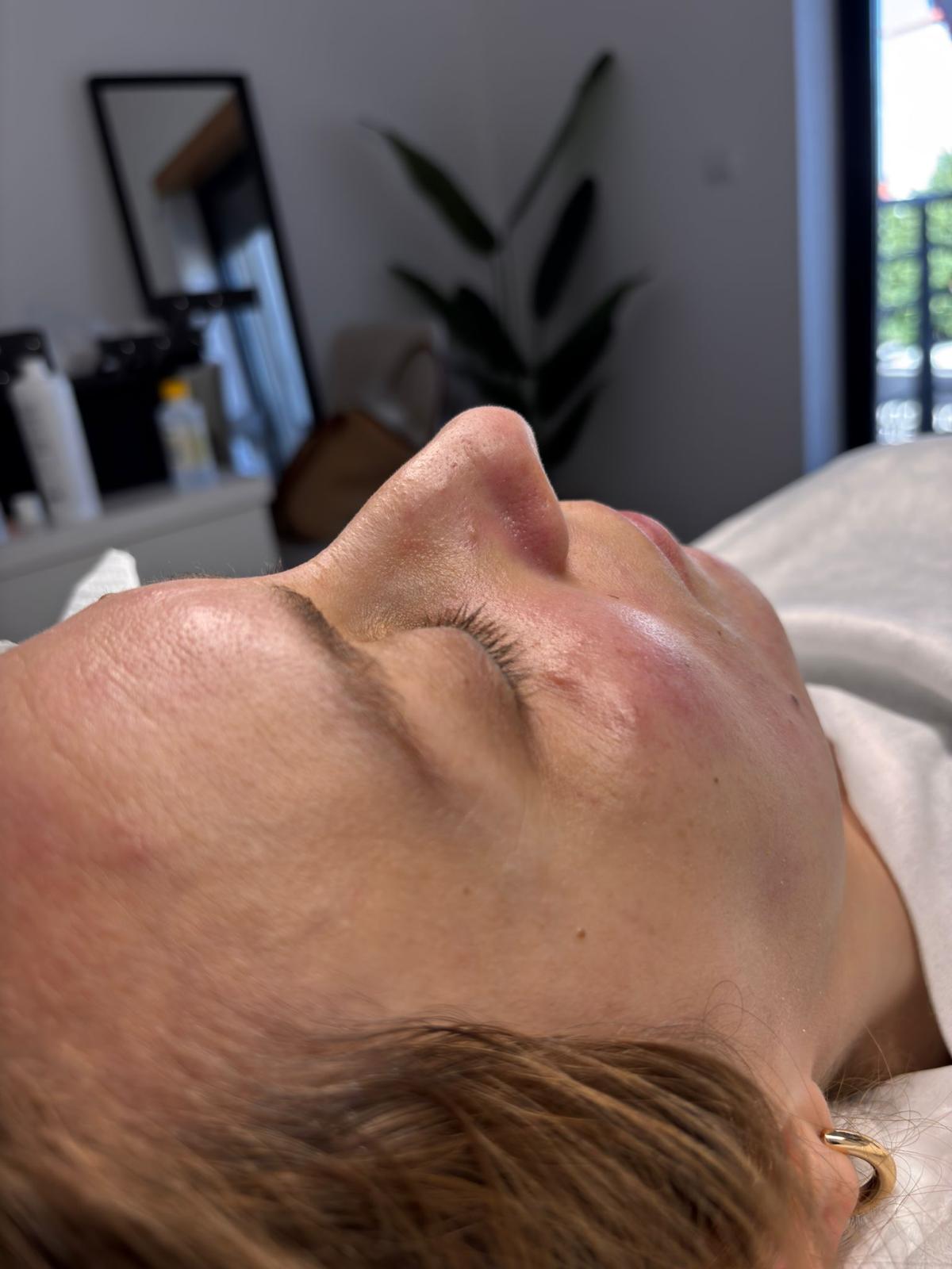 Produtos de estética Ryca Beauty